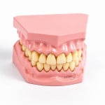 Dental Model Small